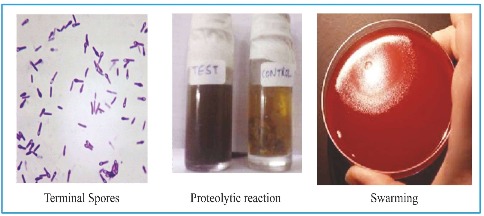 <p><strong>Specimen: </strong>Necrotic Tissue</p><p><strong>Microscope examination</strong></p><ul><li><p>Gram +ve Bacilli</p></li><li><p>Spores: Terminal (drumstick appearance)</p></li></ul><p><strong>On blood agar:</strong> Concentric movement is seen- Swarming</p><p><strong>Gelatin Stab:</strong> Fir tree appearance(as organism will work maximally at the bottom).</p><p><strong>Robertson's Cooked Meat Broth:</strong> Black color; proteolytic reaction.</p>