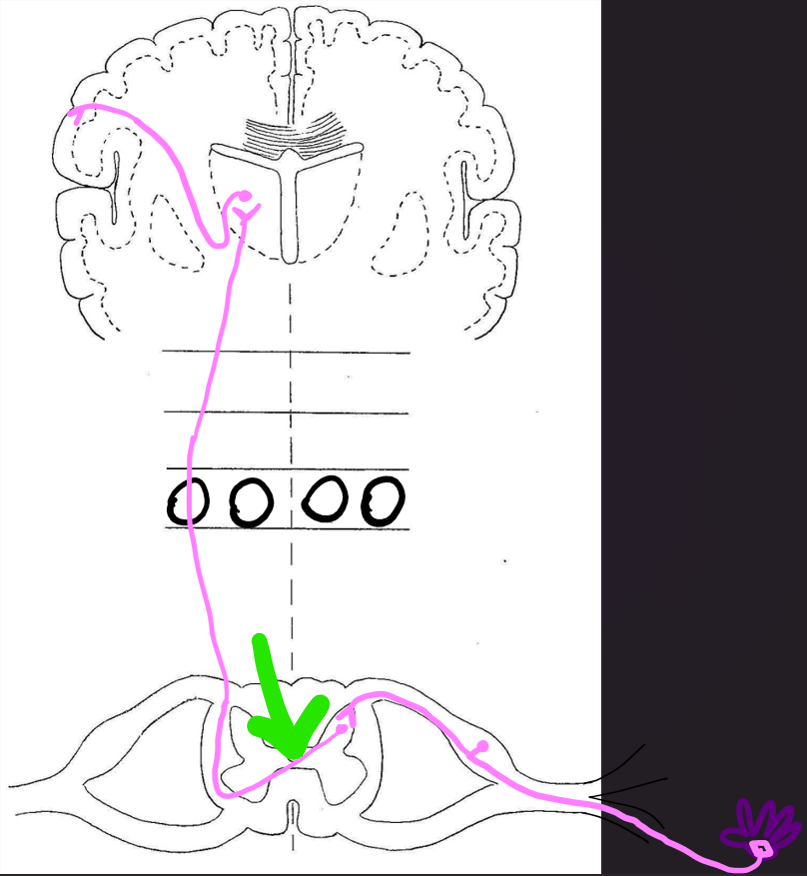 <p>at level of spinal cord. 2nd order neuron.</p>