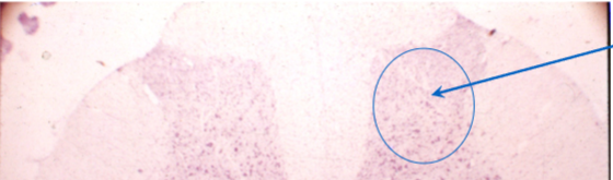 <p>secondary sensory neurons</p>