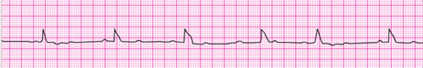 <p>IV or IO access</p>