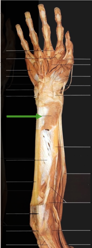 <p>Identify</p>