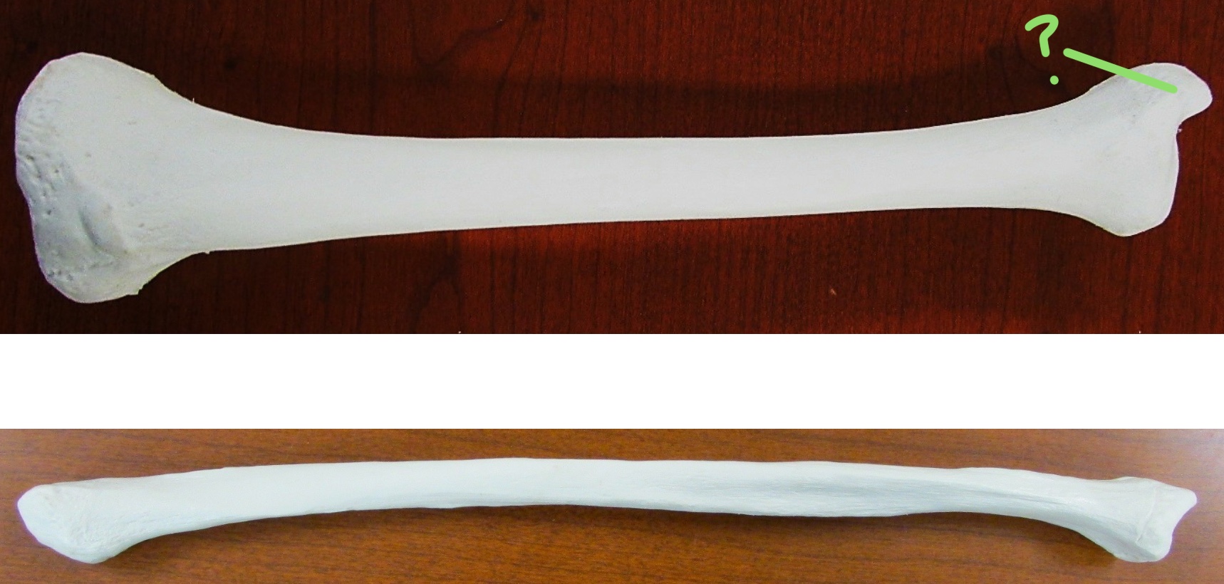 <p>Determine the part of the Femur highlighted</p>
