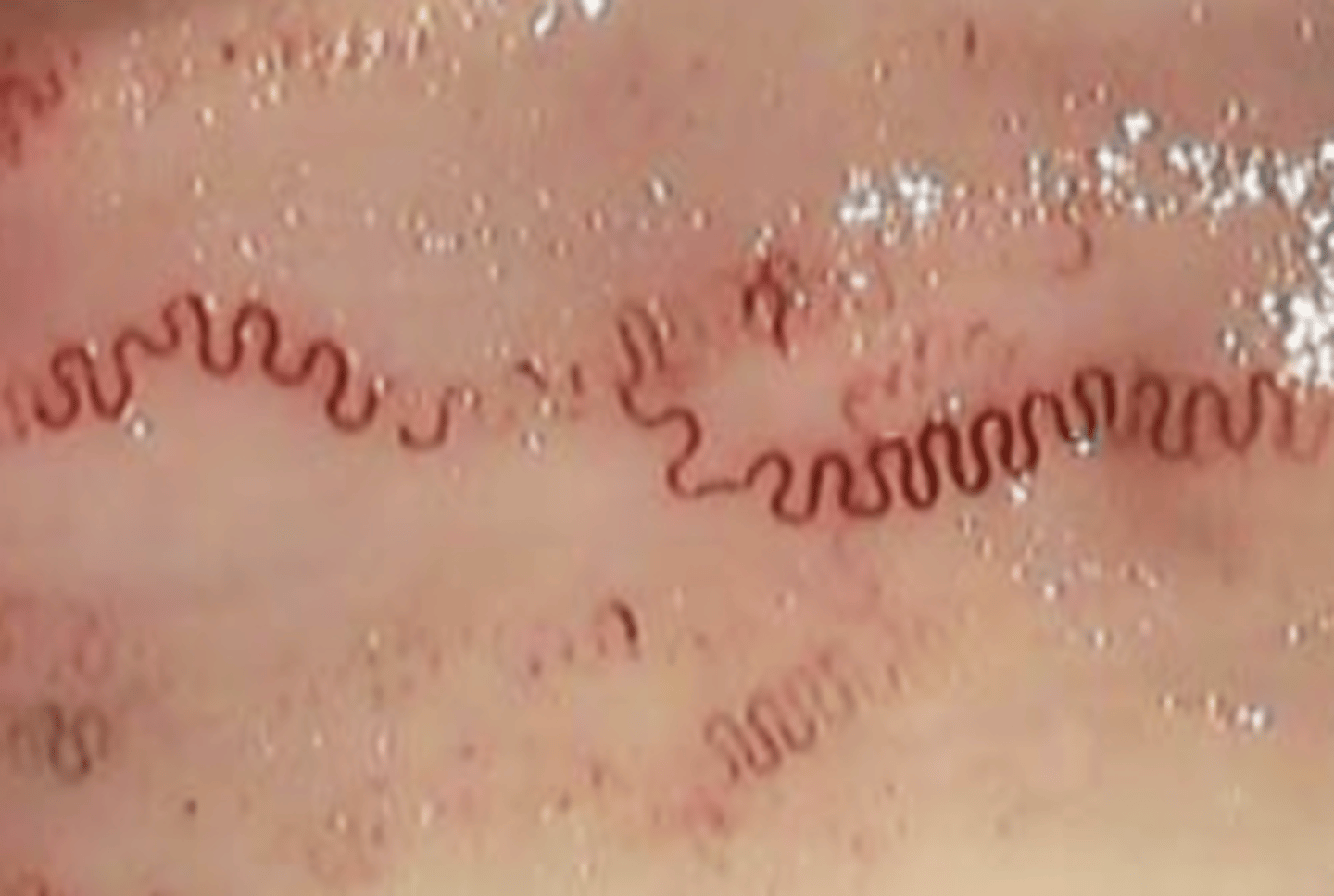 <p>what is this parasite in this esophagus? this animal had what disease?</p>