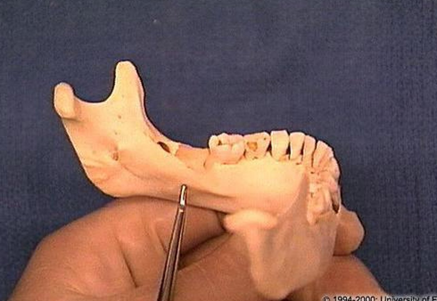 <p>what muscle attaches here?</p>