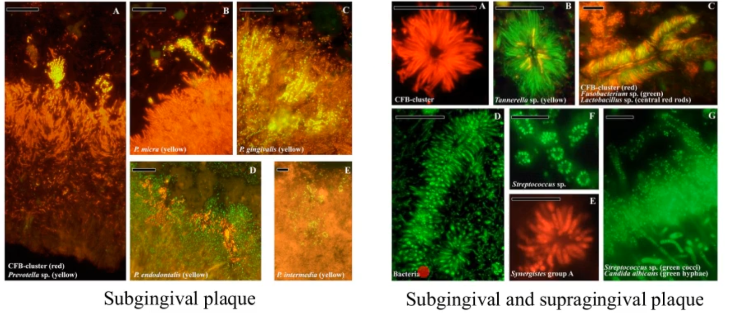 <ul><li><p>can show you the complexes that are formed in the plaque</p><ul><li><p>probes can tell you the species (using conserved and variable regions)</p></li><li><p>microscopy fluorescents can help you visualize the complex</p></li></ul></li><li><p>confirms</p><ul><li><p>the predominate species in the plaque</p></li><li><p>localization and associations </p></li></ul></li></ul><p></p>