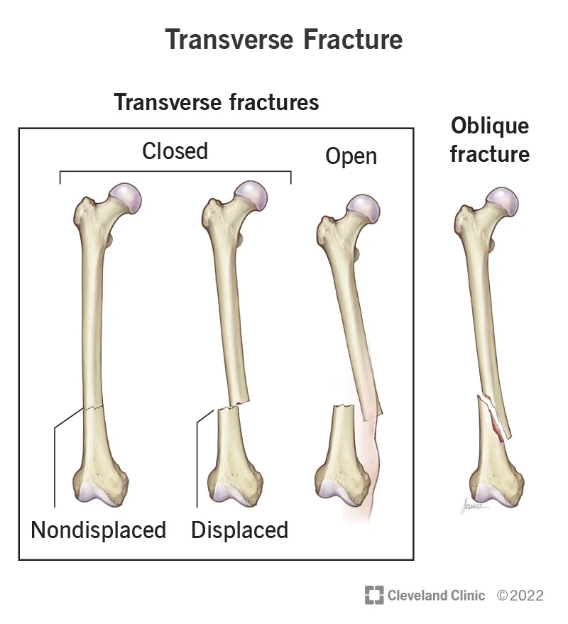 result in new and abnormal bone arrangements