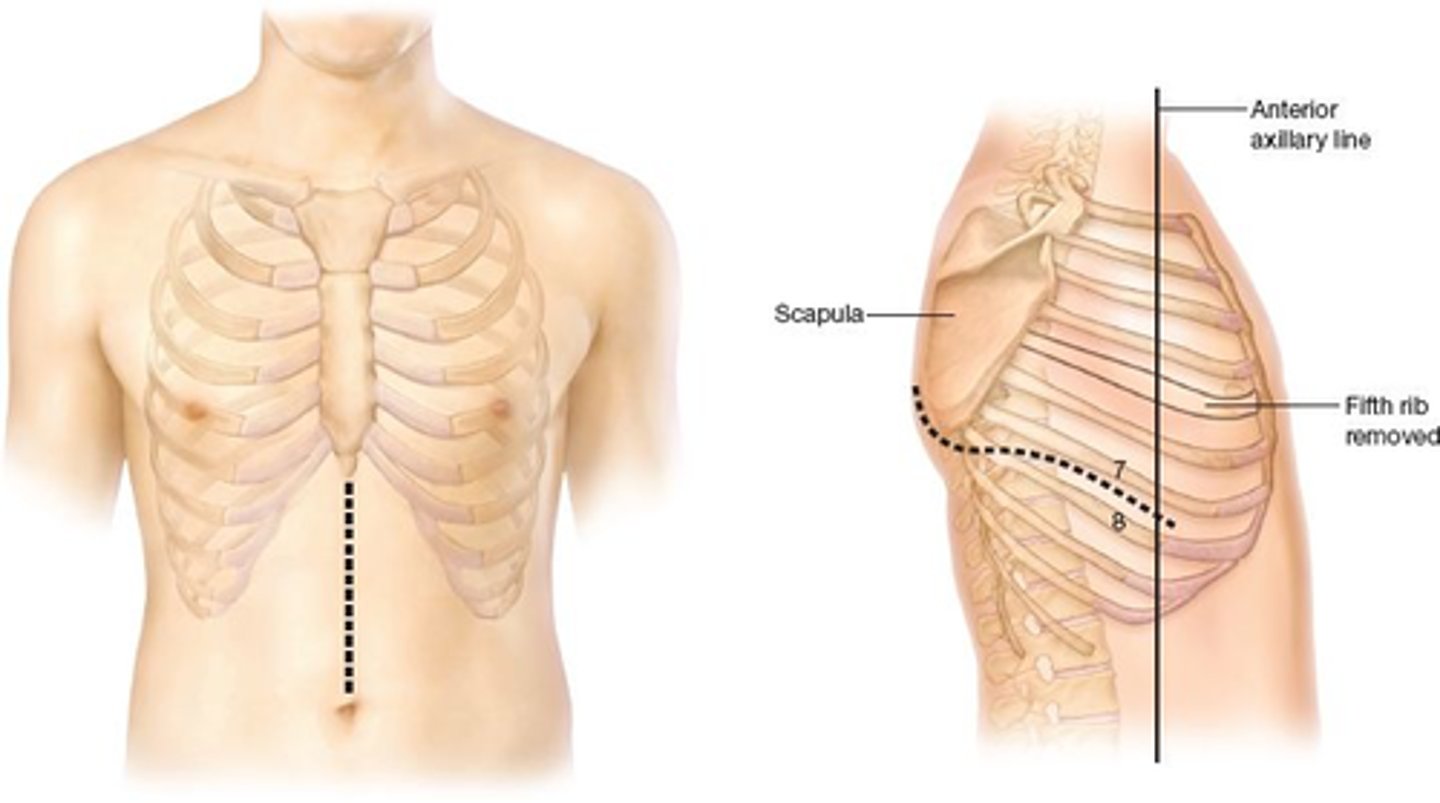 <p>Abdominal incision &amp; right thoracotomy</p>
