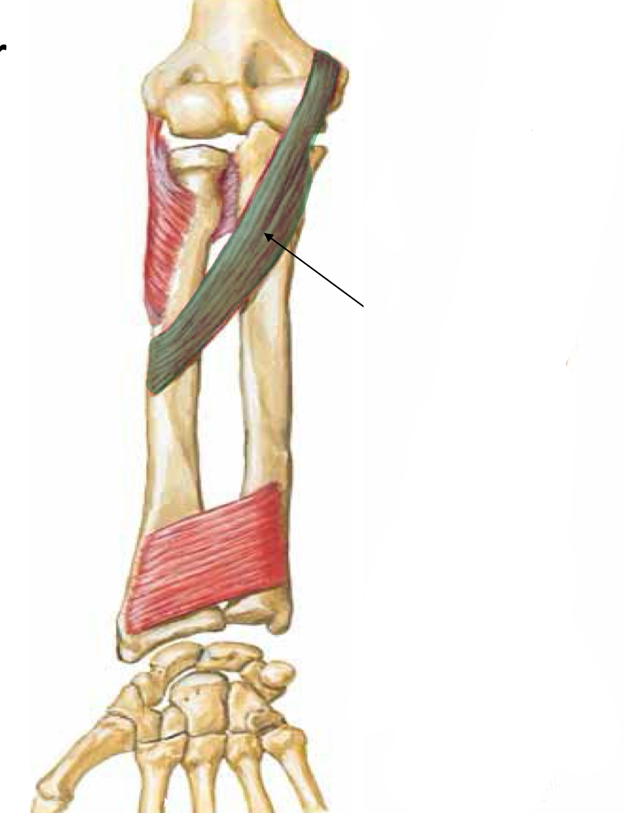 <p>What muscle is indicated?</p>