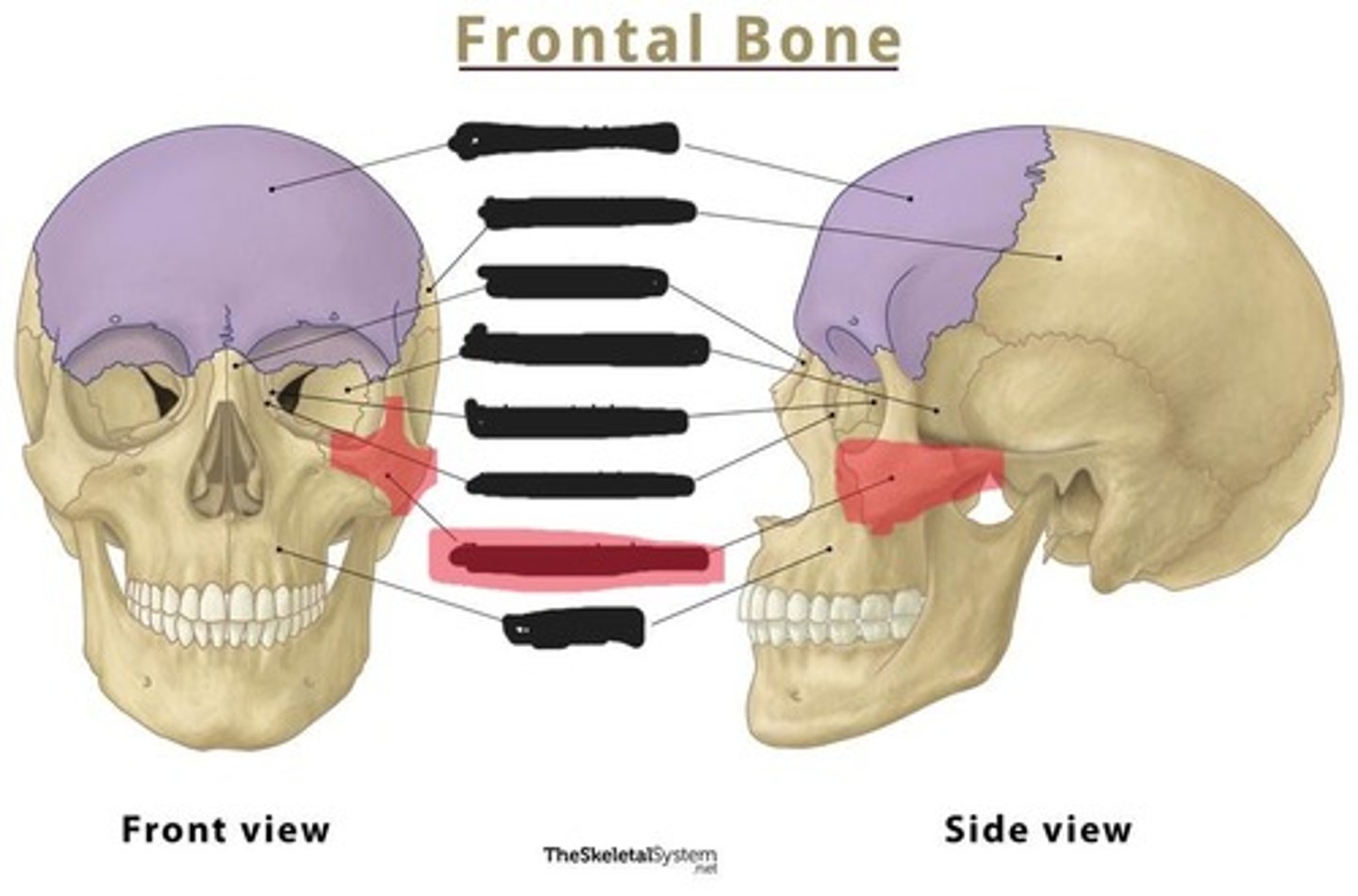 <p>zygomatic bone</p>