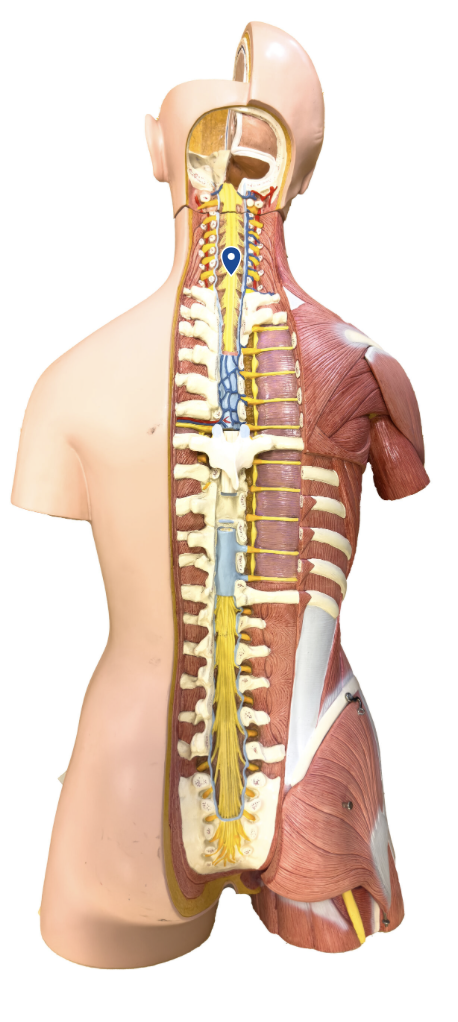 <p>What region of the spinal cord is the arrow pointing to?</p>