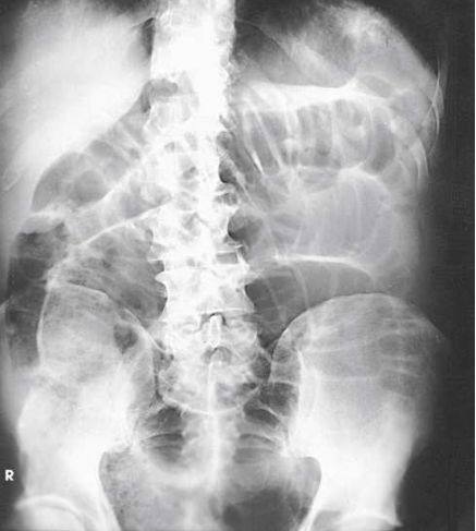 <p>What projection, position and anatomy is this?</p>