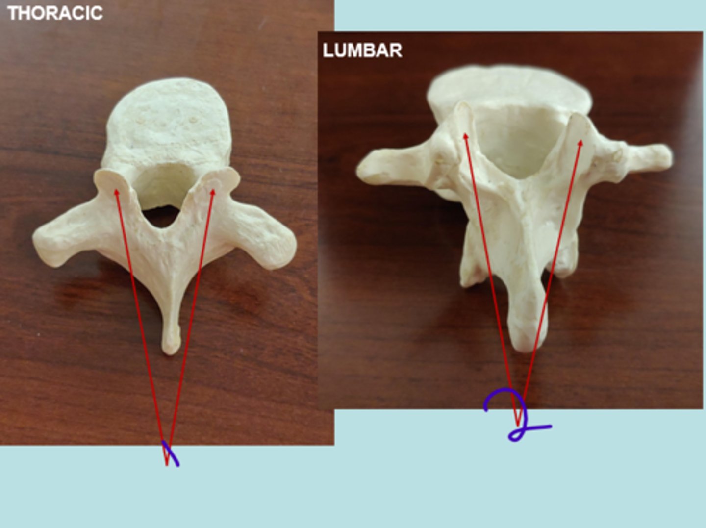<p>Lumbar 2</p>