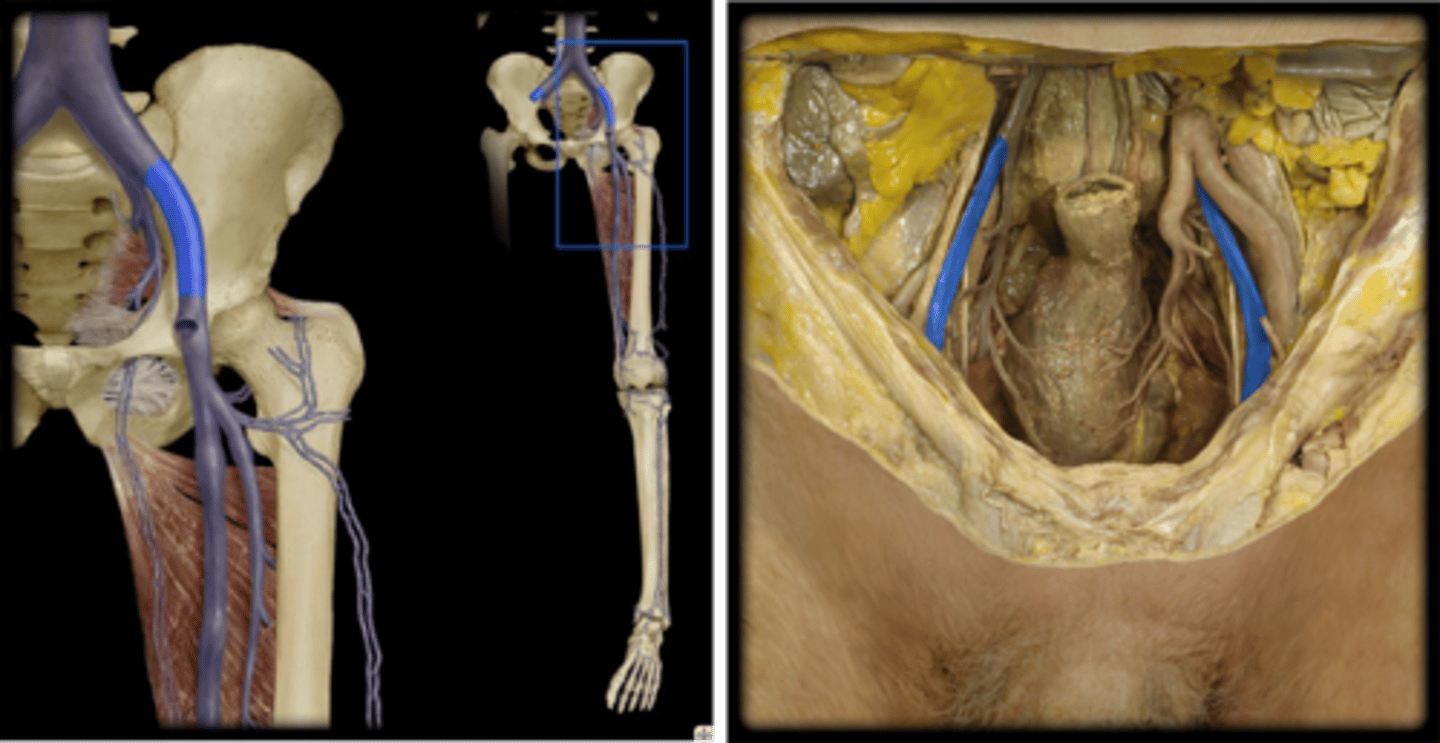 <p>Name these vessels.</p>