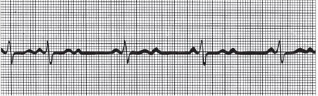 <p>What kind of rhythm is this? </p>