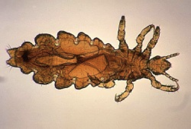 <p>what group of lice</p>
