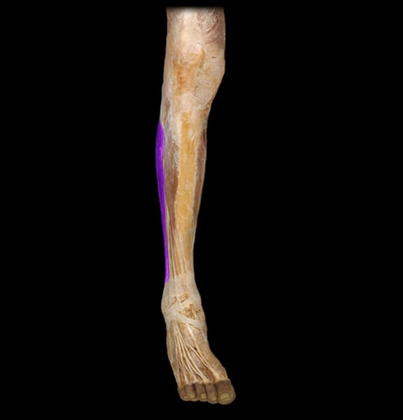 <p>IDENTIFY THIS MUSCLE</p>