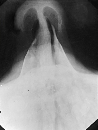 <p>What is this x-ray demonstrating?</p>