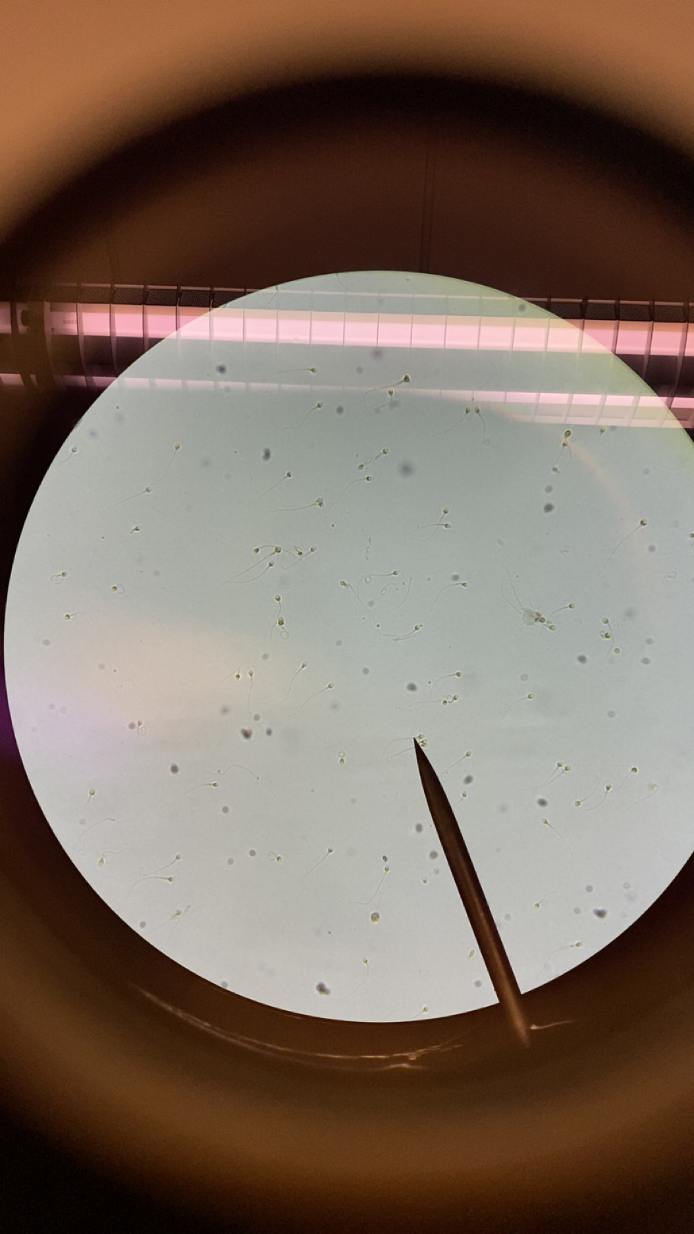 <p>What microscope tissue is this ?</p>