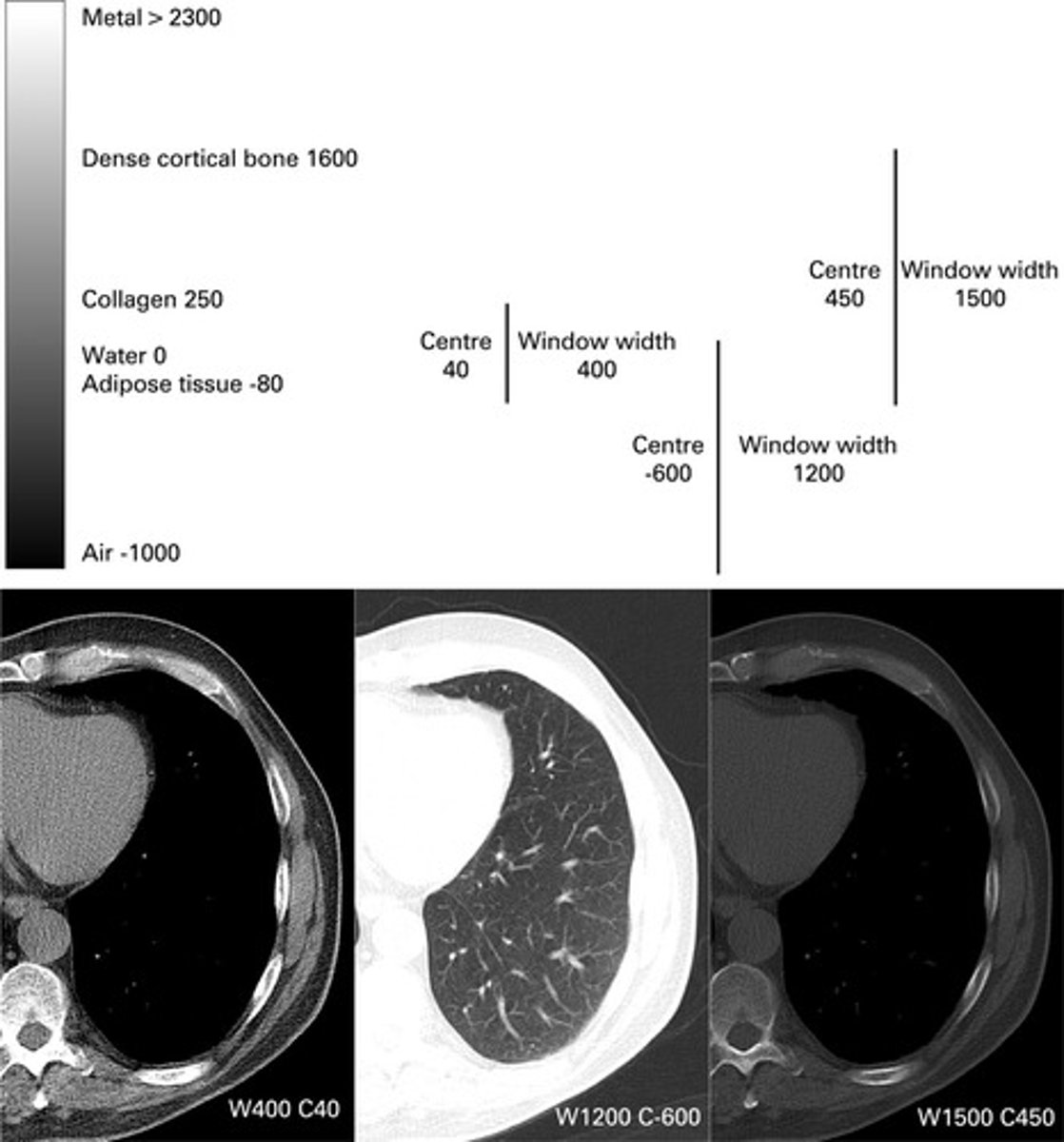 <p>How well you can tell different tissues apart based on shades of gray.</p><p>The ability to distinguish two objects with similar attenuation values, which is a major advantage of CT imaging.</p><p>Ex: If you can tell that the nodule is a little denser (whiter) than the surrounding lung tissue, that’s because of good contrast resolution (differences in gray shades).</p><p></p>