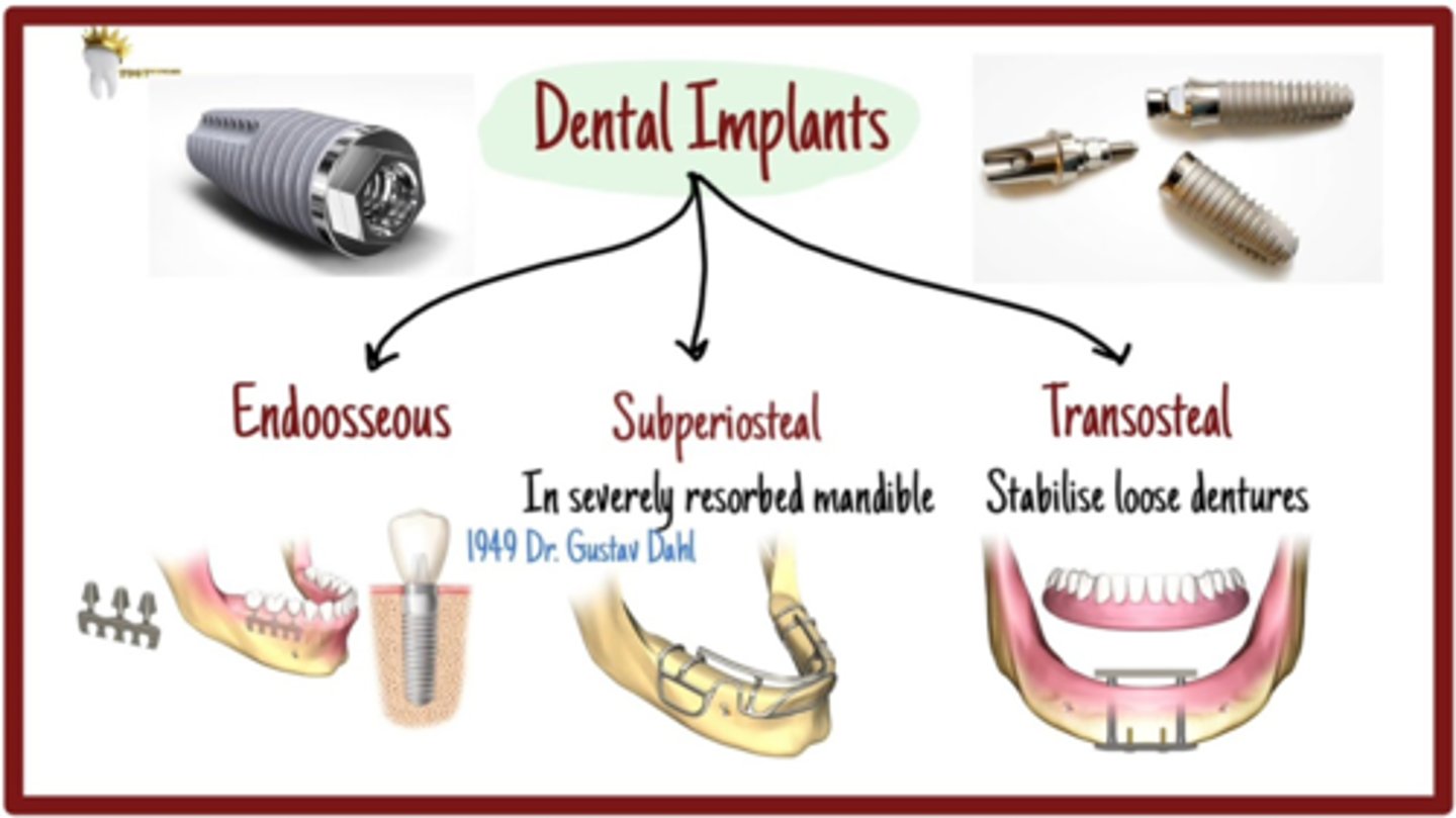 <p>- Endosteal (within bone)</p><p>- Periosteal (sits on jaw)</p><p>- Transosteal (through bone)</p>