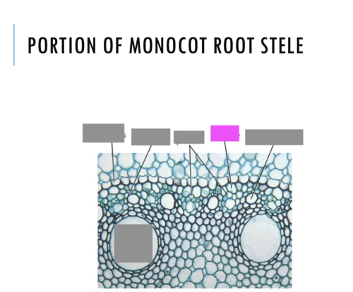 <p>Name the pink highlighted structure.</p>