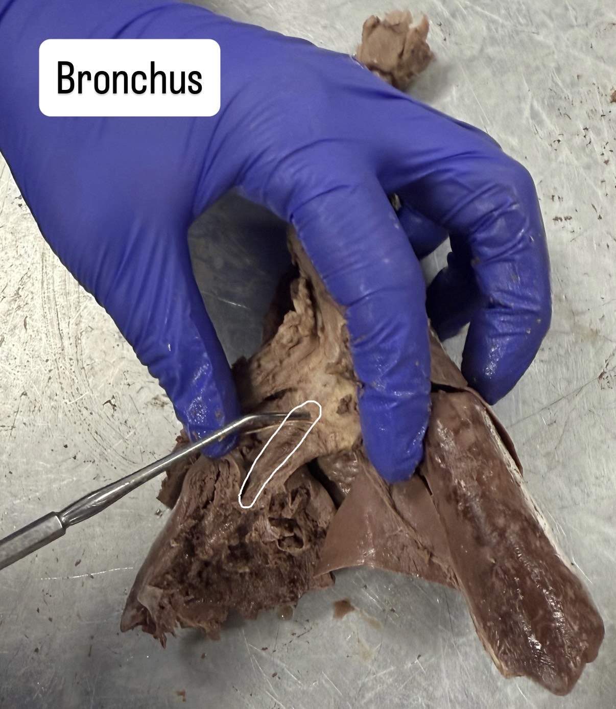 <p>Bronchus</p>