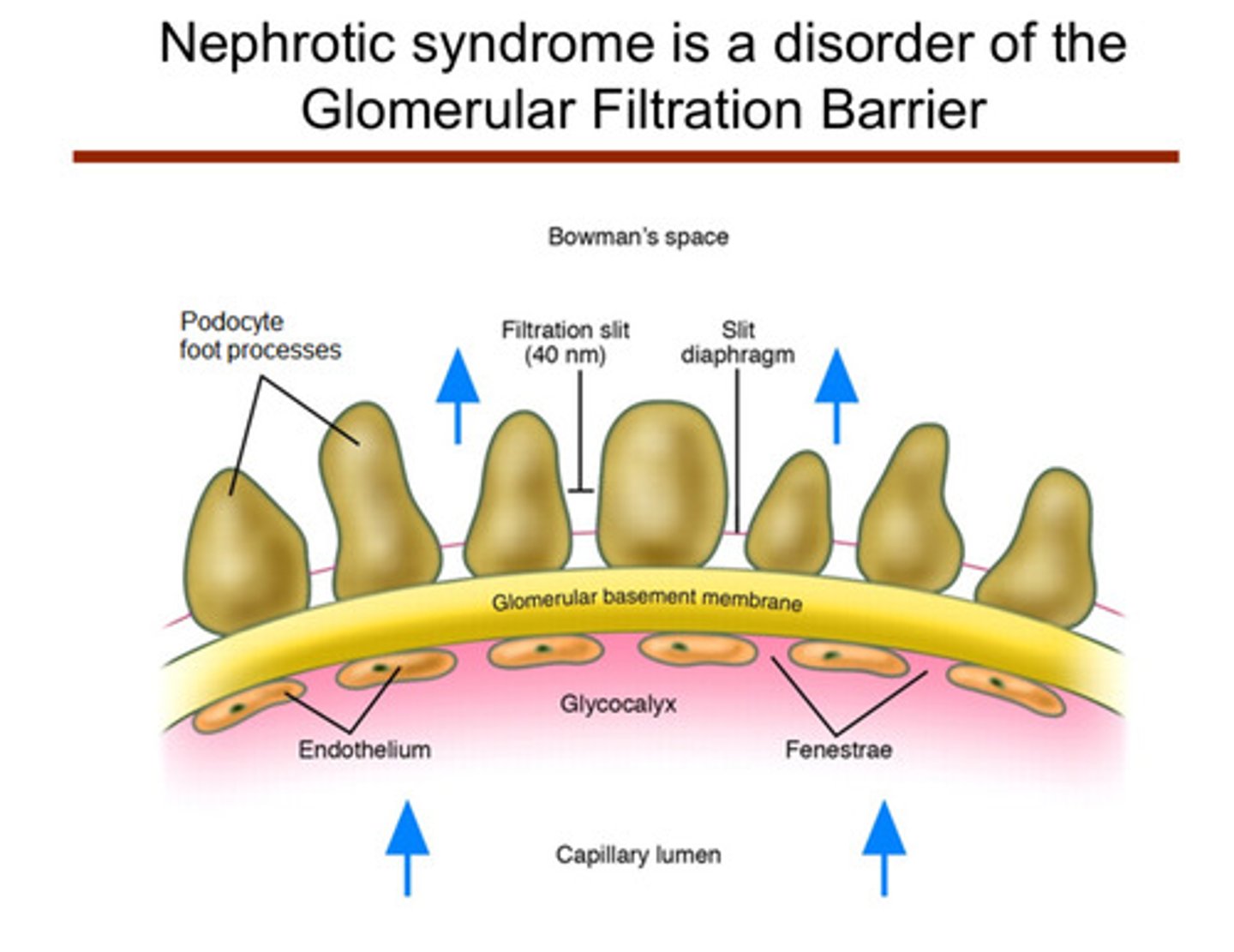 <p>nephrotic syndrome is mainly a disorder of the glomerular filtration barrier</p>