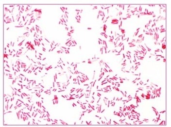 <p>Lose crystal violet and stain red from safranin counterstain.</p>