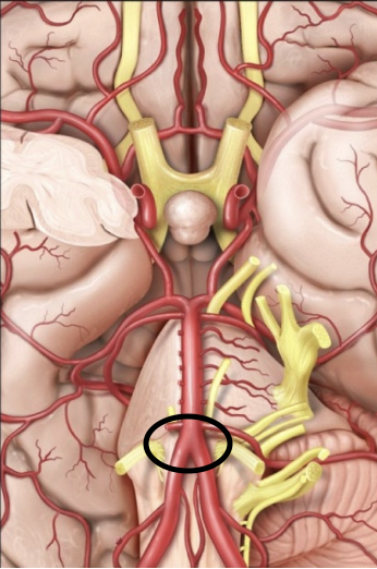 <p>An artery that supplies blood to the brainstem and cerebellum.</p>