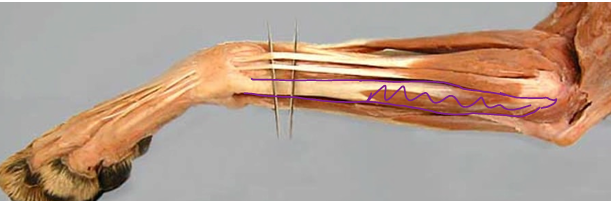 <p><span>Antebrachial Region (Forearm)</span></p>