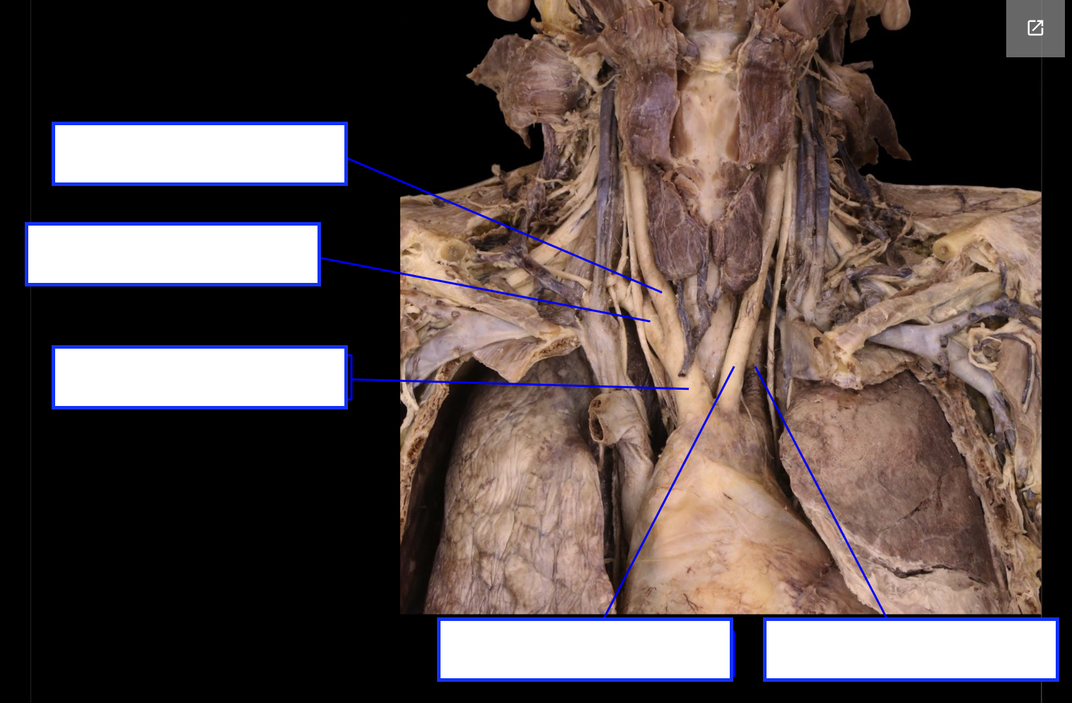 <p>middle left (artery)</p>