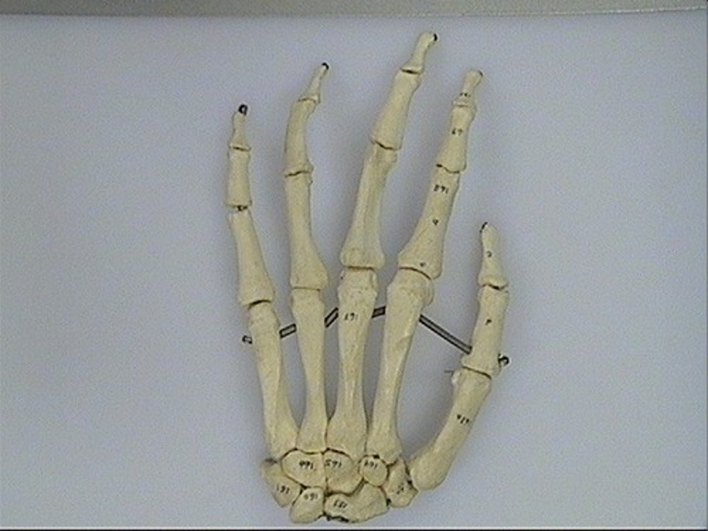 <p>right or left?</p>