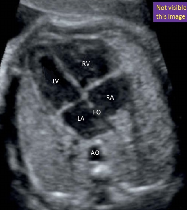 <p>bottom right</p>