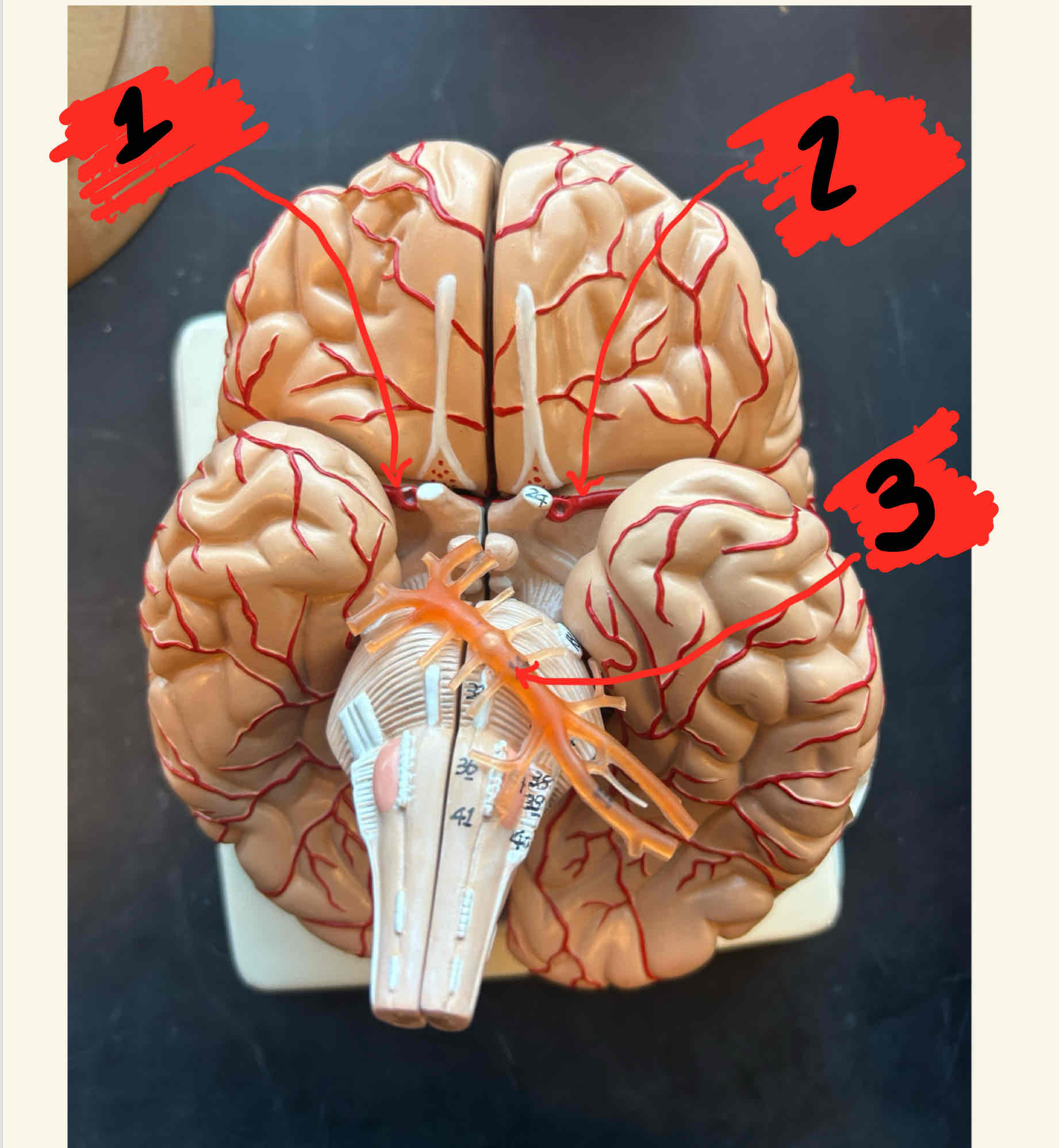 <p>What is the structure labeled 2</p>