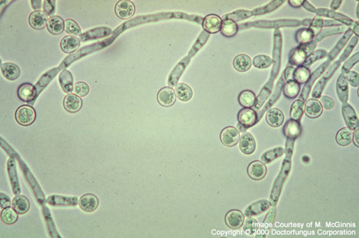 <p>Gist (veroorzaker Candidiasis)</p>