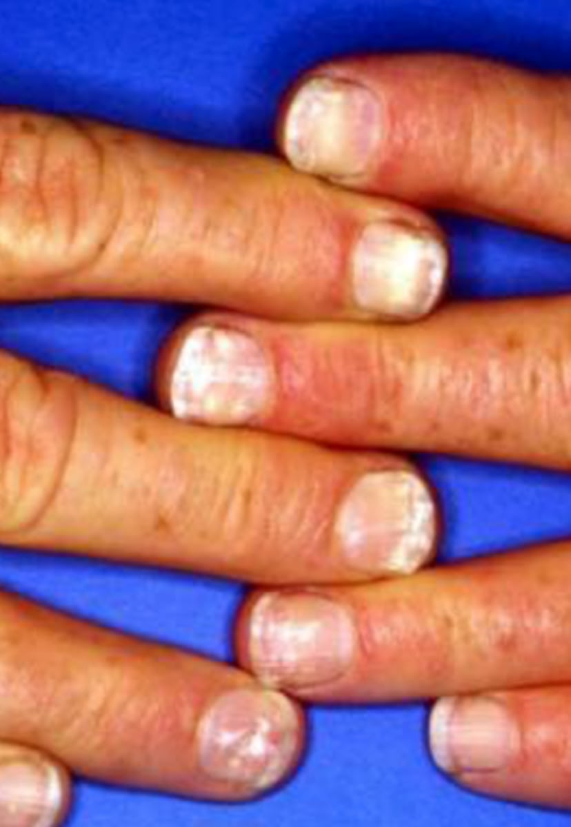 <p>What is the diagnosis?</p>