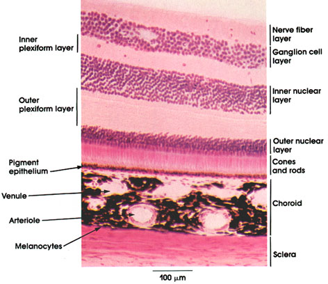 <p>The depicted microscopic slide shows a _______</p>