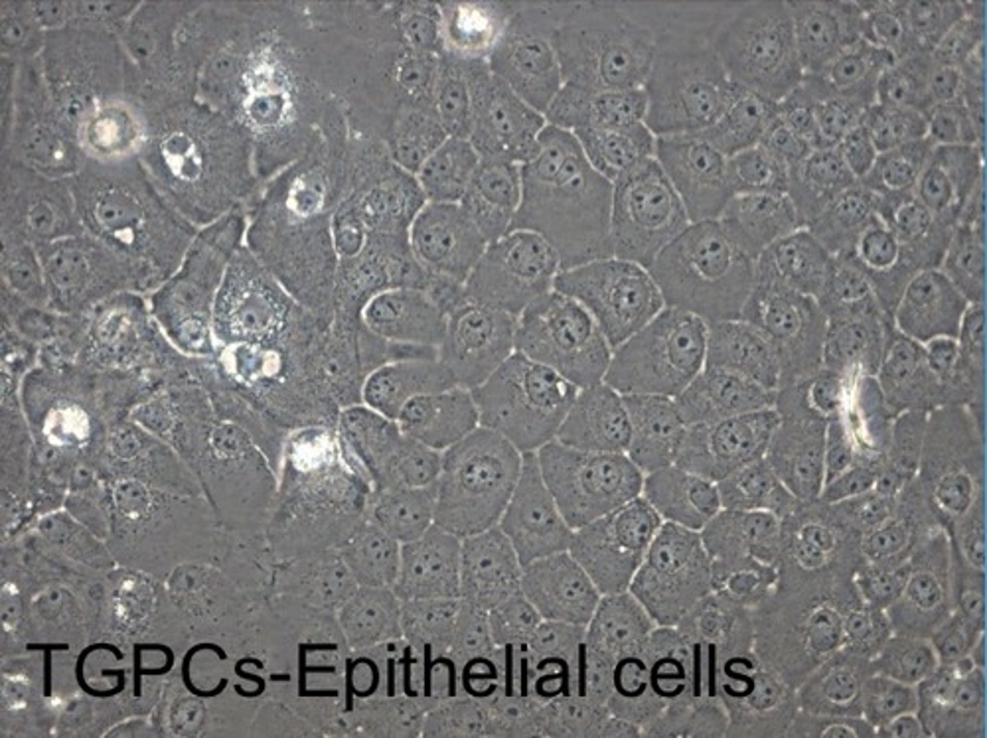 <p>epithelial tooth germ progenitor cells (TGPCs)</p>