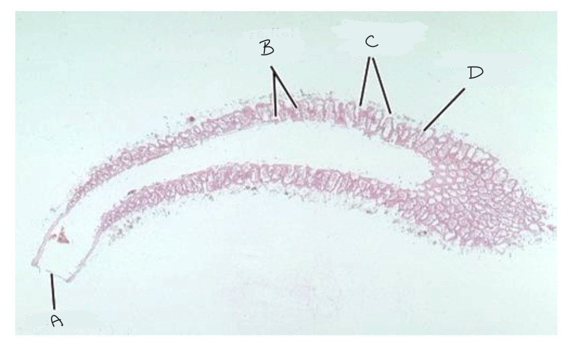 <p>What part of the Grantia is labeled A</p>