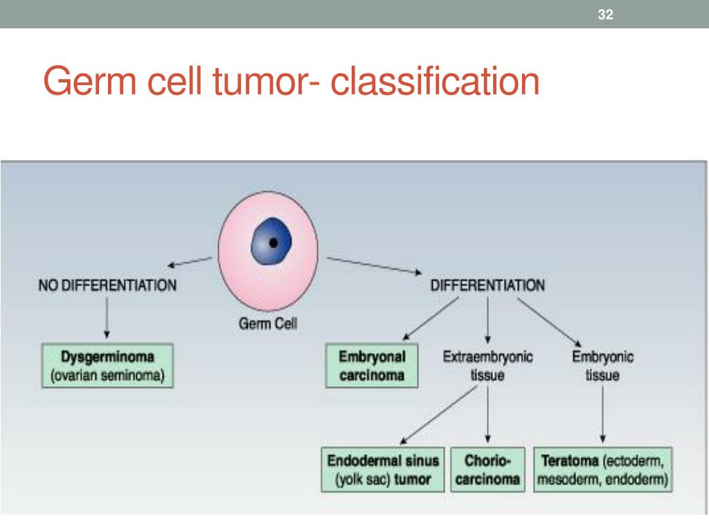 germ cell tumour