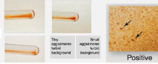<p>Agglutination Grading</p>