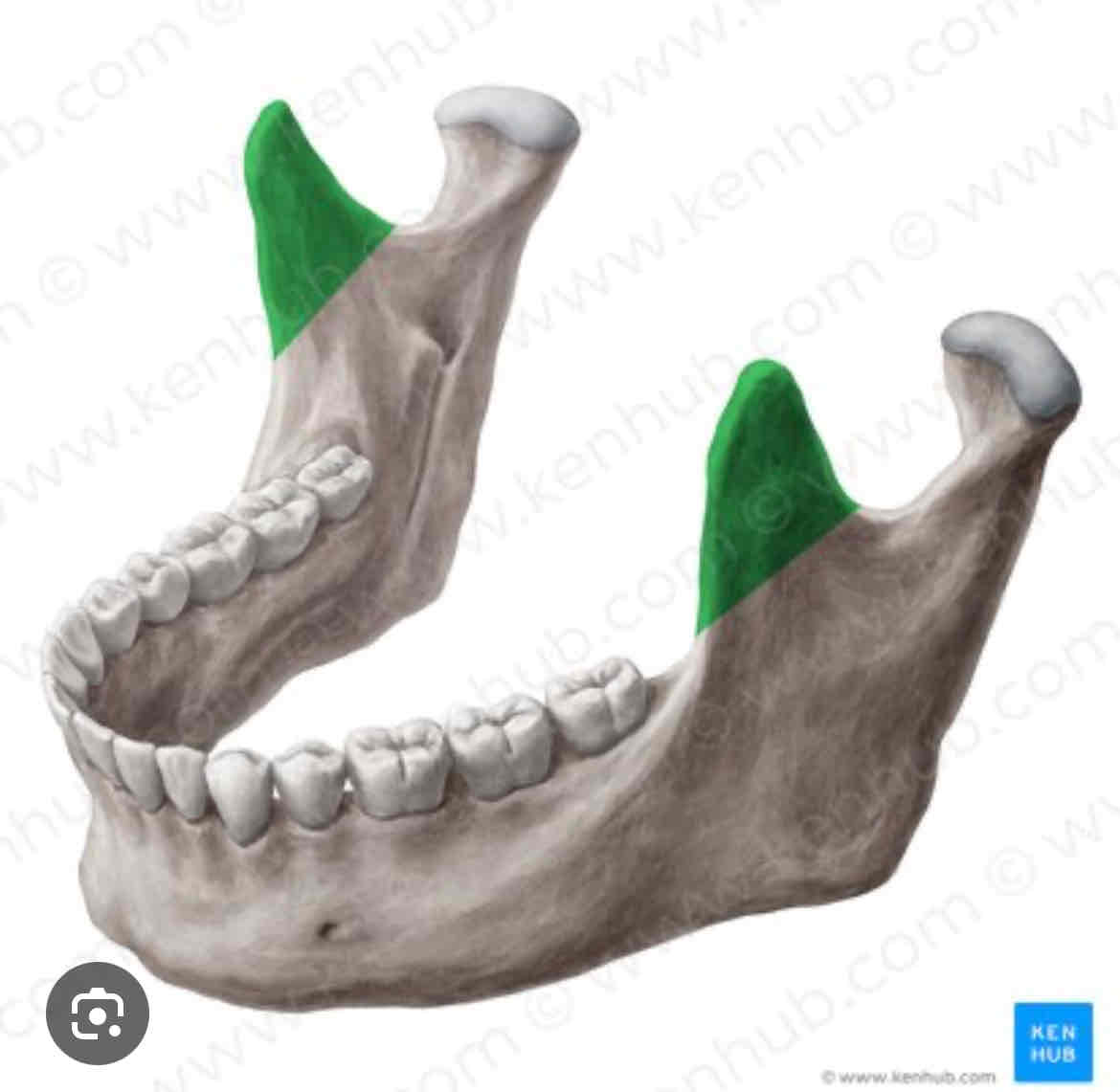knowt flashcard image