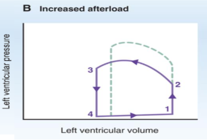 <p>How does increased afterload (aortic pressure) affect a PV loop?</p>