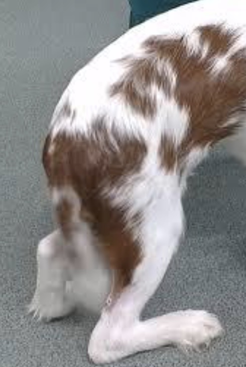 gait disorder: calcaneal tendon rupture