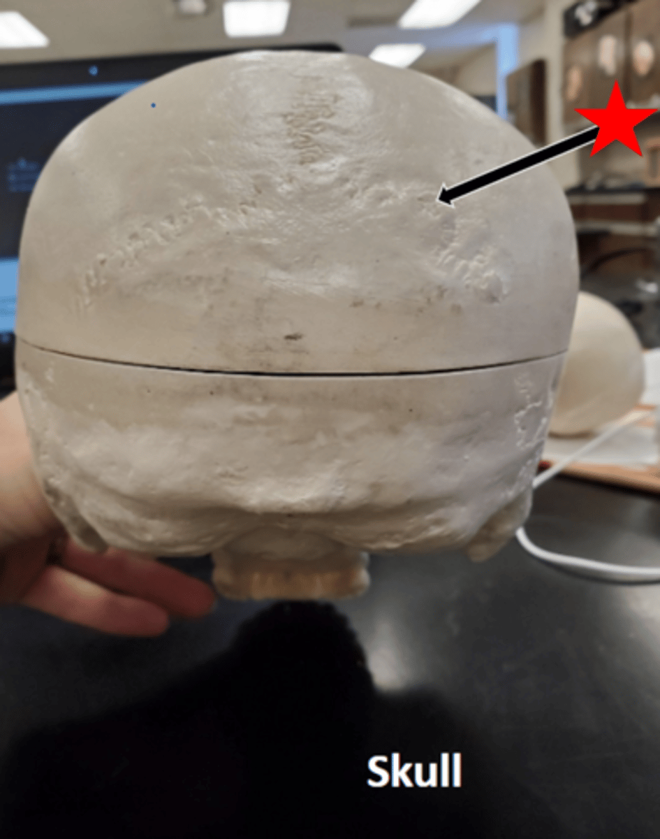 <p>Name the suture the arrow is pointing to in the image.</p>