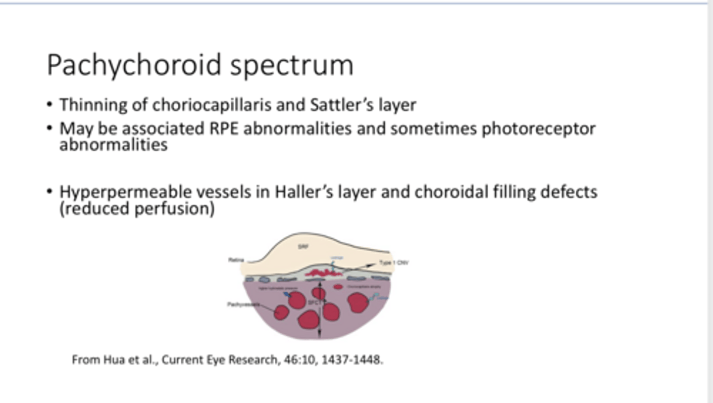 <p>Dilation of the vessels in Haller's layer of the choroid can lead to thinning of what other layer?</p>