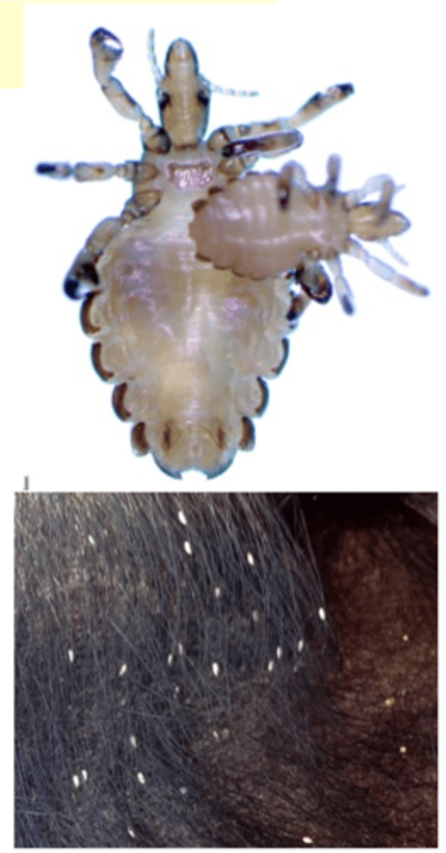 <p>• Clinical signs: scratching &amp; rubbing, alopecia, anaemia in</p><p>young pigs;</p><p>• Visualization of lice on the body and eggs attached to the hairs of the pigs;</p>