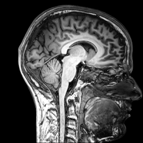 use of magnetic fields, radio waves and computerized enhancements to map the brain, better at mapping the brain than CTs