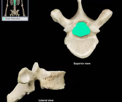Round or oval opening through a bone