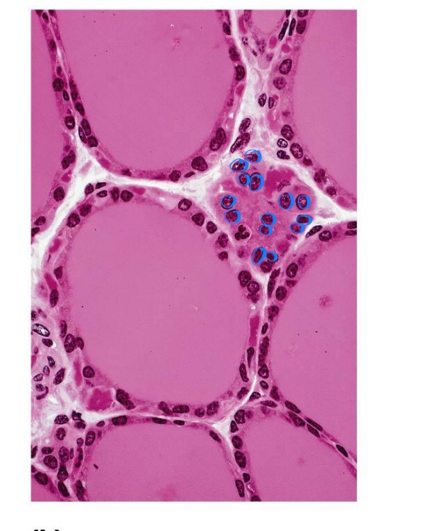 <p>Thyroid gland </p>